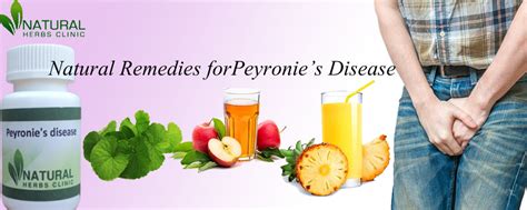 Marvelous Natural Remedies To Treat Peyronies Disease