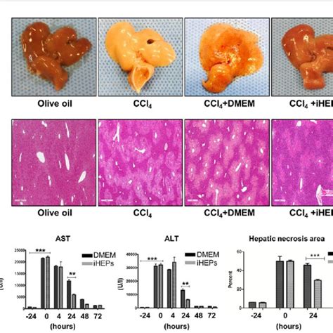 CCl 4 Induced Chronic Hepatic Fibrosis Was Significantly Attenuated By