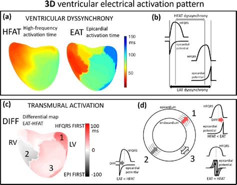 Interpretation Of Difference Between Ecgi And Hfecgi Derived Activation