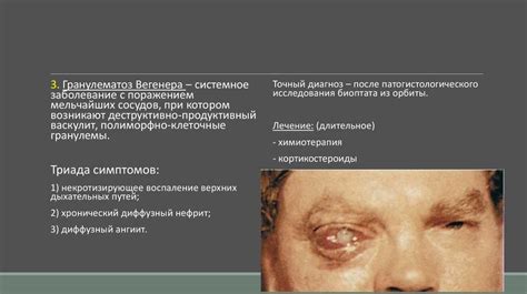 Заболевания глазницы - online presentation