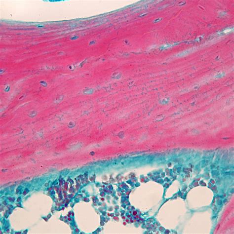 Mammal Fibrocartilage Slide 10 µm Hande Carolina Biological Supply