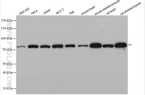PFKP antibody (13389-1-AP) | Proteintech | 武汉三鹰生物技术有限公司
