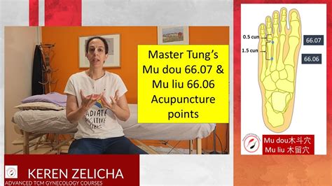 Master Tung S Mu Dou 66 07 And Mu Liu 66 06 Acupuncture Points YouTube