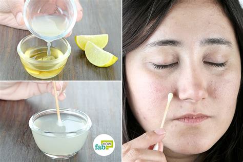 13 Ways to Remove Dark Spots with Lemon Juice | Fab How