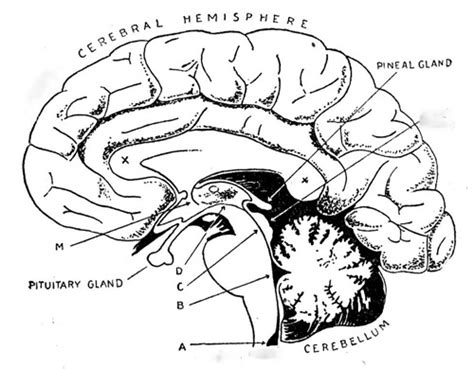 Pineocytoma