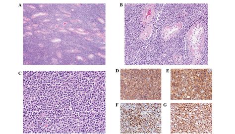 A C Histological And D G Immunohistochemical Findings A The