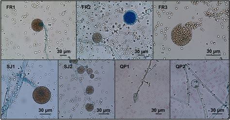 Conidia Sporangia And Hyphae Of Mucor Isolates Fr1—m Download