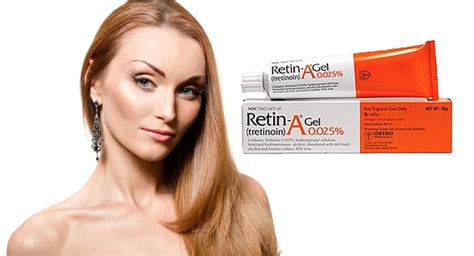 Is Tretinoin An Effective Treatment For Acne