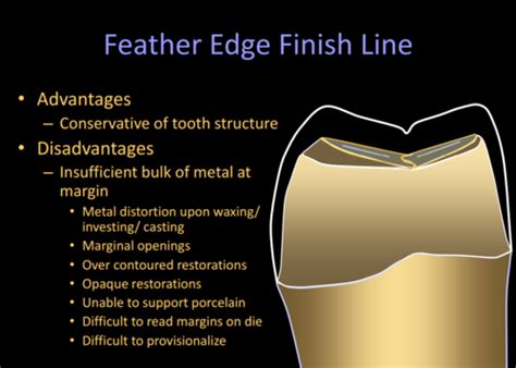 Pros Esthetic Finish Lines Flashcards Quizlet