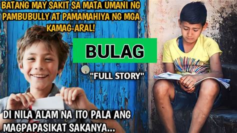 Batang May Sakit Sa Mata Umani Ng Pambubully At Pamamahiya Ng Mga Kamag