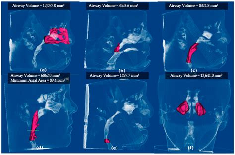 Anatomia Free Full Text Three Dimensional Assessment Of The