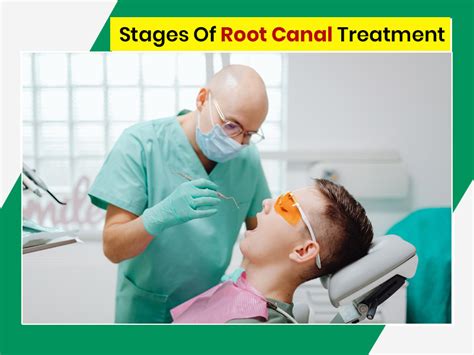 5 Stages Of Root Canal Treatment The Correct Procedure OnlyMyHealth