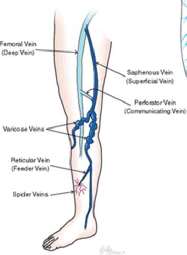 Arterial And Venous Diseases Flashcards Quizlet