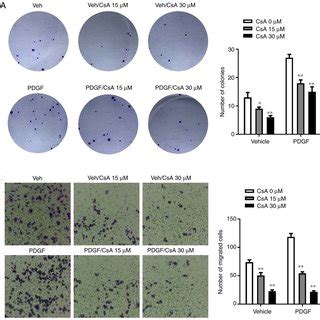 Proliferation And Migration Of PASMCs Following Pretreatment With