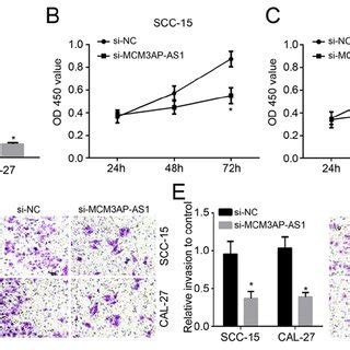 Knockdown Of Mcm Ap As Inhibits Oral Squamous Cell Carcinoma Cell