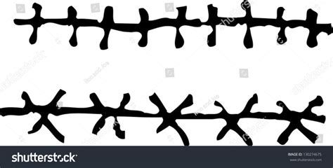 Black And White Vector Illustration Of Stitches - 130274675 : Shutterstock