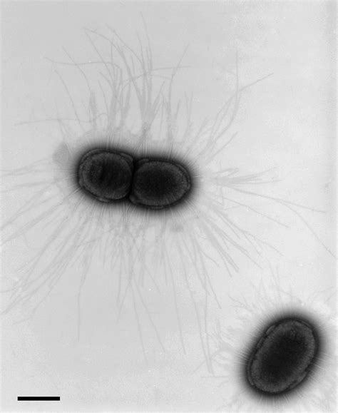 Klebsiella Negative Stain