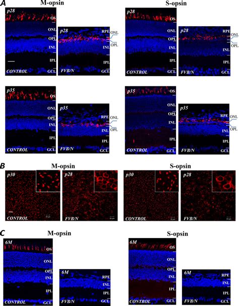 Antibody Labeling Of M And S Opsin Molecules Red In The Cone OS