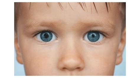 Pupil Size Difference What Is Anisocoria Obn