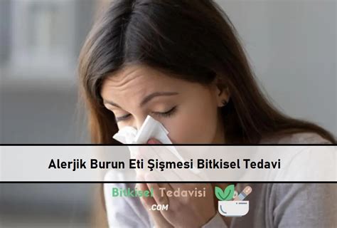 Alerjik Burun Eti Şişmesi Bitkisel Tedavi Bitkisel Tedavi