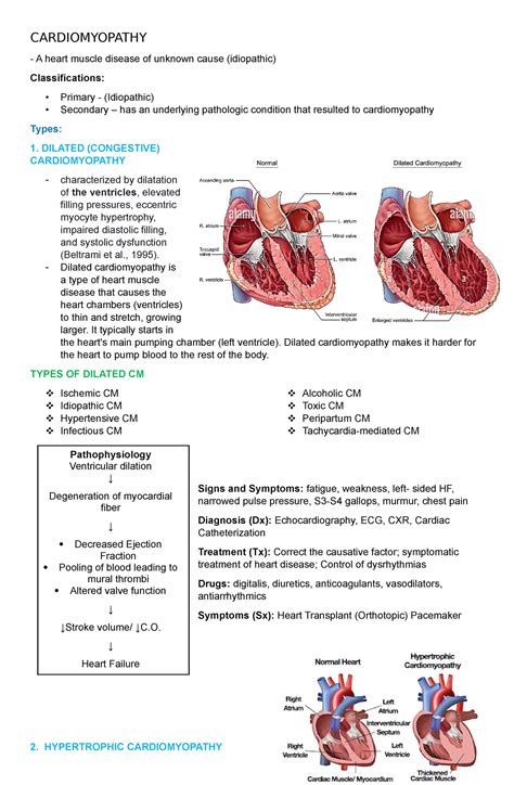 Cardiomyopathy Notes Cardiomyopathy A Heart Muscle Disease Of
