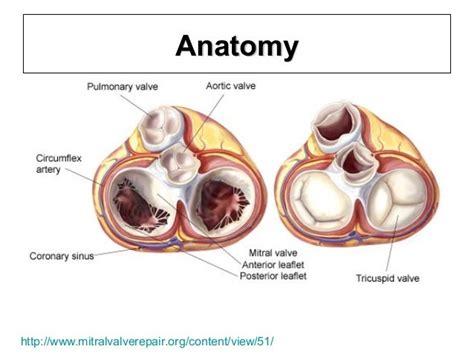 Systolic Anterior Motion Of Mitral Valve Sam