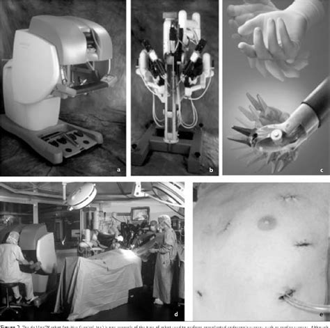 Figure 2 From Robot Assisted Surgery A Review Semantic Scholar