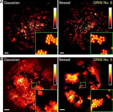 Figures And Data In High Throughput Synapse Resolving Two Photon