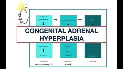 Congenital Adrenal Hyperplasia Adrenal Enzyme Deficiencies Mcqs