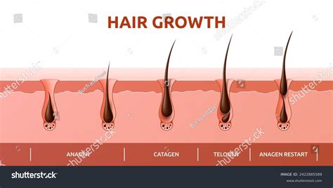 Hair Growth Cycle Of Follicles Phase Diagram Royalty Free Stock Vector 2422885589