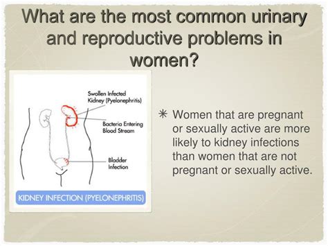 Ppt What Is Urology Powerpoint Presentation Free Download Id 5053885