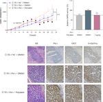 Dna Polymerase Iota Promotes Esophageal Squamous Cell Carcinoma