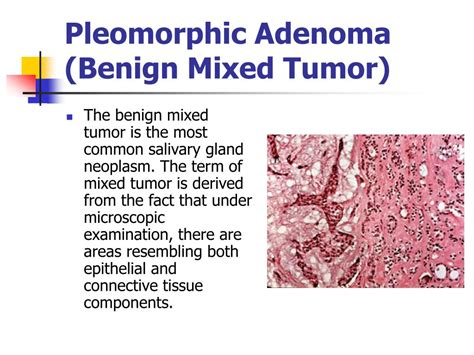 Ppt Neoplasia Powerpoint Presentation Free Download Id 1384968