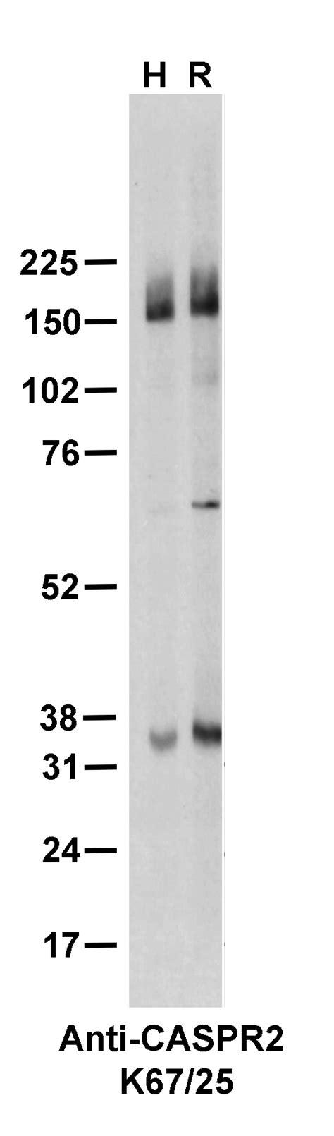 Addgene Antibody Data Hub Anti Caspr K R In Western Blot Rat