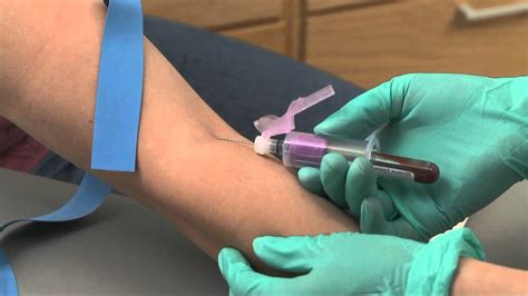 Safe And Effective Blood Draw YouTube