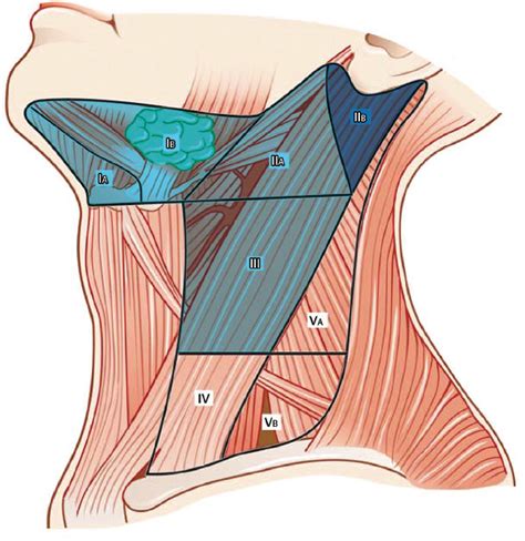 Selective Neck Dissection Ento Key