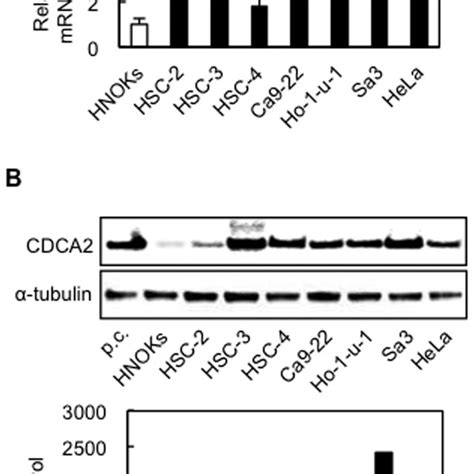 Evaluation Of Cdca2 Expression In Oscc Derived Cell Lines And The Hela