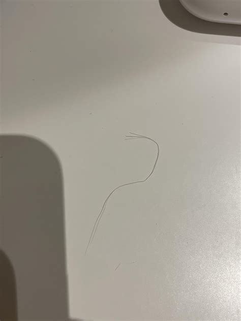 What Causes Hair To Fall Out Like This Short And Thick With Long Thin