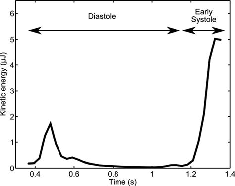 Volume Tracking A Novel Method For Visualization And Quantification