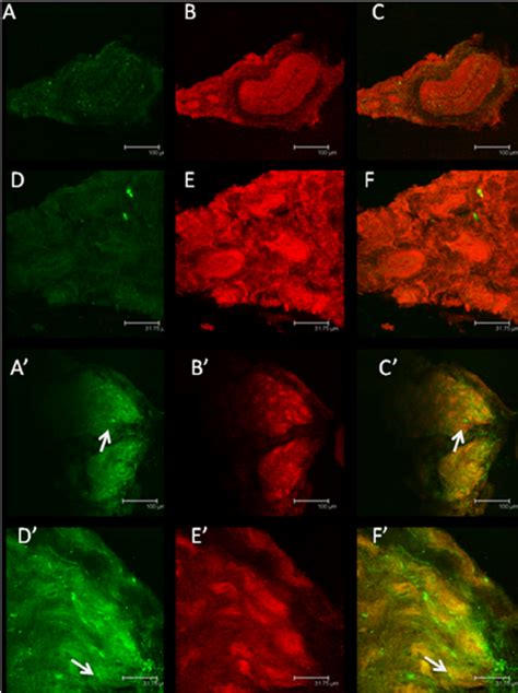 Immunolocalization Of B R Shown Are Confocal Microscopy Pictures Of