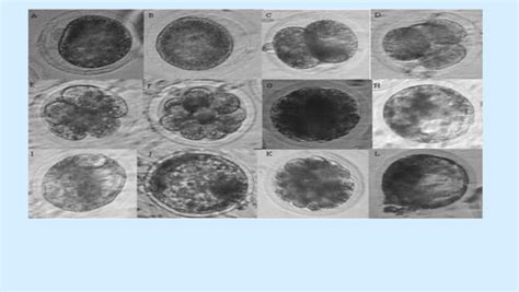 Lecture 20 Superovulation And Embryo Transfer In Cattle Ppt