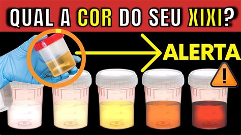 O que significa a COR da sua URINA Qual INDICA doença GRAVE Quais