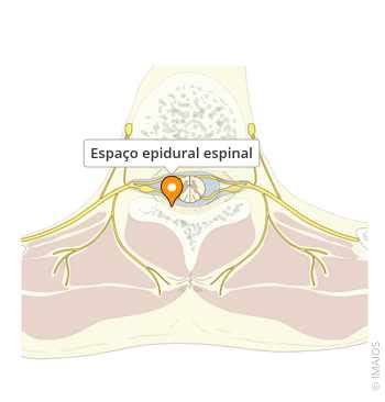 O Espaço Epidural Está Situado Entre - Espaço epidural espinal - e-Anatomy - IMAIOS