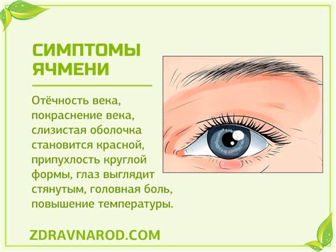 Ячмень | Народная медицина