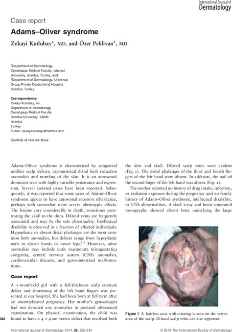 Adamsoliver Syndrome Kutlubay 2014 International Journal Of