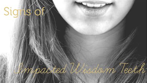 Signs Of Impacted Wisdom Teeth Cannon Park Dental