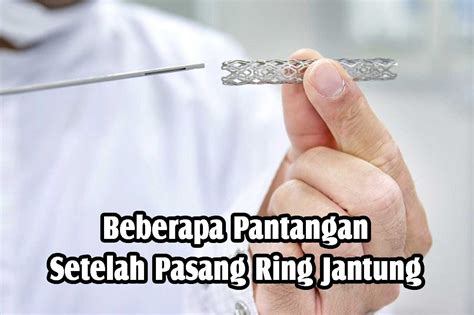 10 Pantangan Setelah Pasang Ring Jantung Yang Wajib Diketahui Nutra