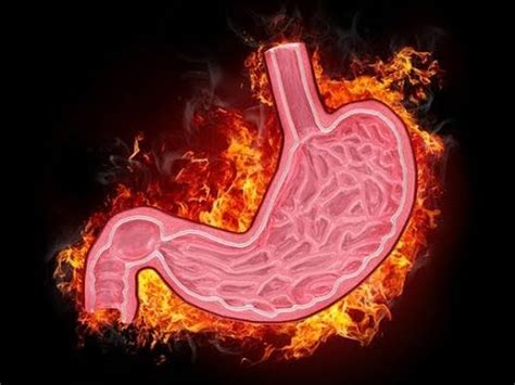 Cómo combatir la gastritis nerviosa con este remedio de origen natural