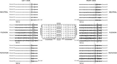 Organisation And Position Of The High Density Surface EMG Examples Of