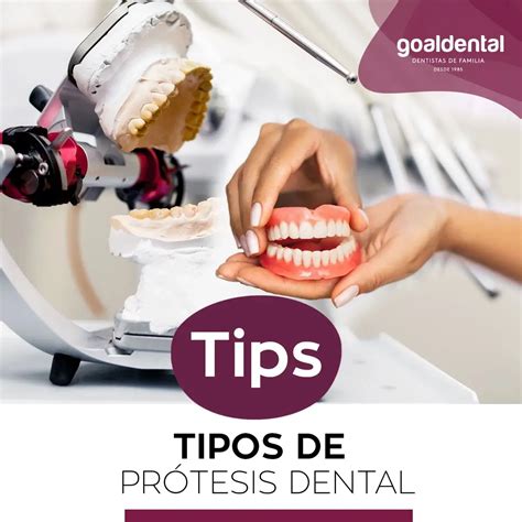 Tipos de Prótesis Dental Clínicas GoalDental